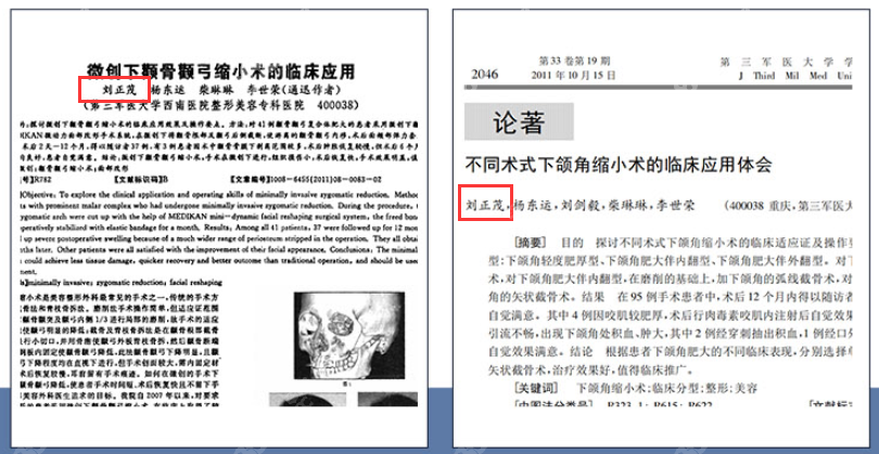 重庆星荣刘正茂磨骨做颧骨/下颌角截骨不歪脸