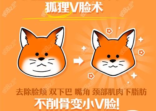 韩国爱她atop狐狸V脸提升术
