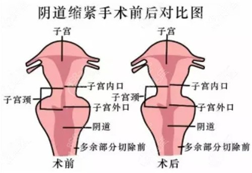 王钰杰医生做私密整形口碑怎么样？