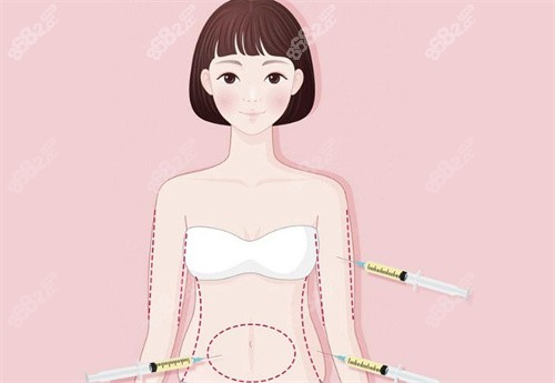 <!--<i data=20240705-sp></i>-->吸脂怎么样?