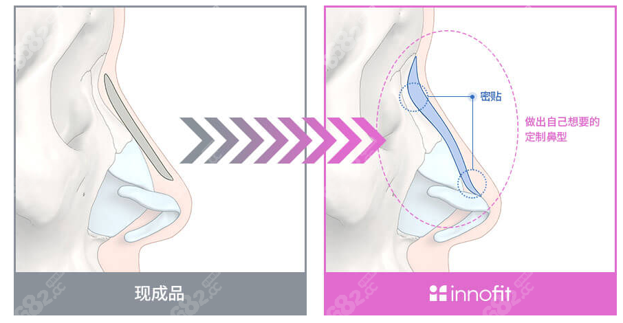 www.8682.cc/韩国GNG医院是韩国假体隆鼻出名的医院