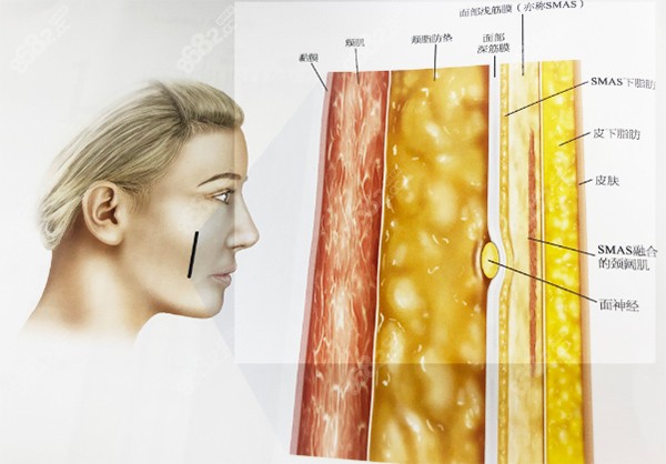 <!--<i data=20240705-sp></i>-->拉皮手术特色——袁生态面部微创提升紧致术