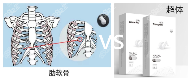 超体隆鼻好还是肋骨隆鼻好