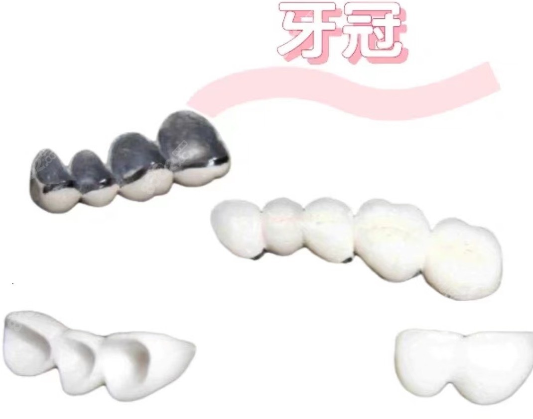 牙齿