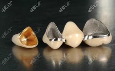 贵金属，金属牙冠