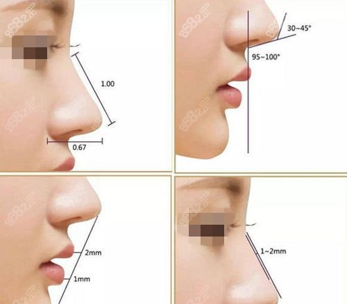 鼻部美學(xué)標(biāo)準(zhǔn)