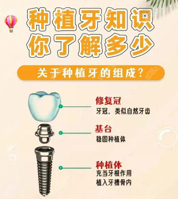 种植牙手术步骤8682.cc