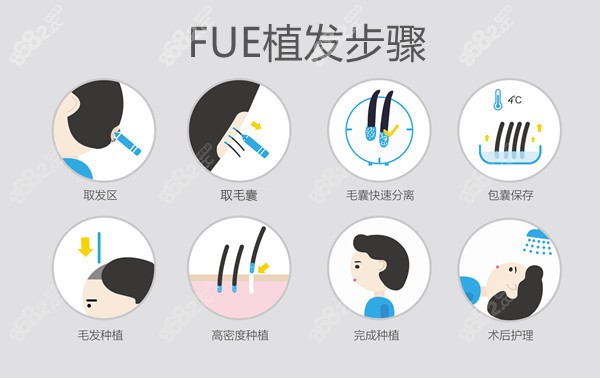 植发步骤__副本.jpg