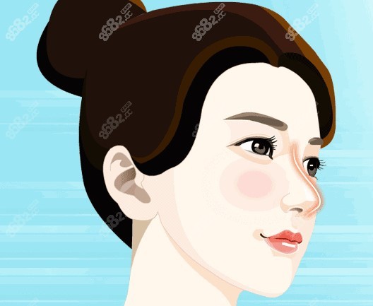 骨鼻修复哪家医院好