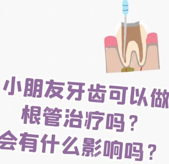 儿童根管治疗有影响吗