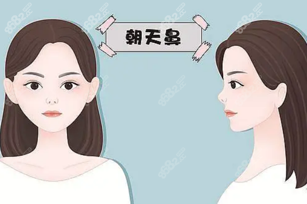 北京联合丽格鼻修复怎么样