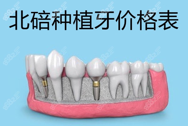 北碚种植牙价格表