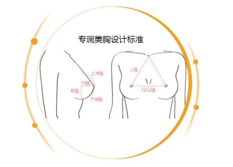 广州曙光假体隆胸好的医生