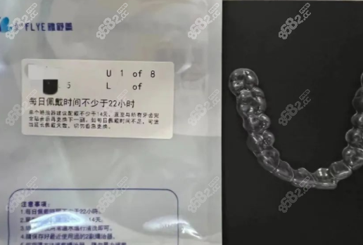 隐形牙套矫正龅牙的佩戴方式