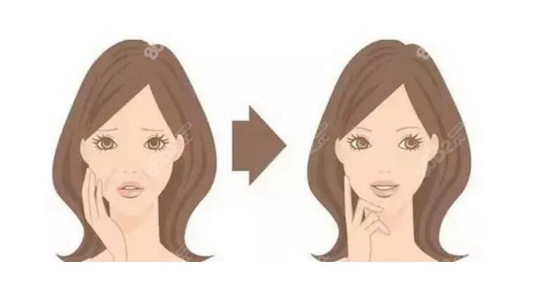 赵拉皮维持多久