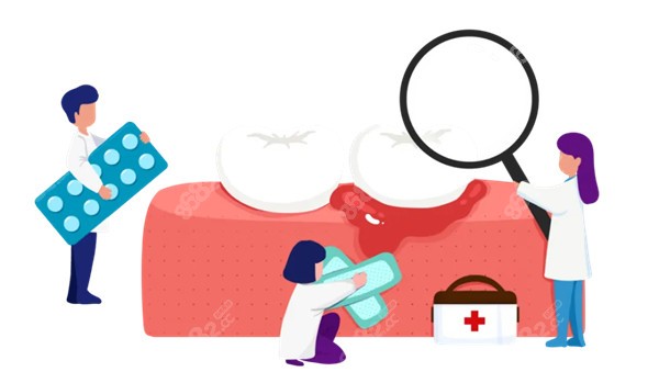 拔牙后引起干槽癥原因8682.cc