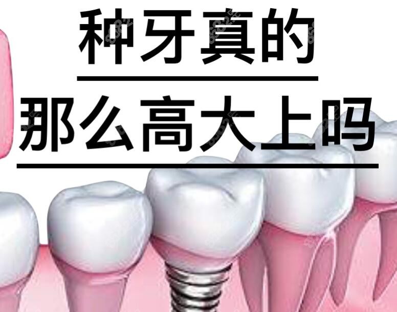 种牙真的那么高大上吗