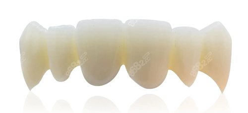 什么材质的牙冠结实还可以做核磁共振当然非全瓷牙冠莫属