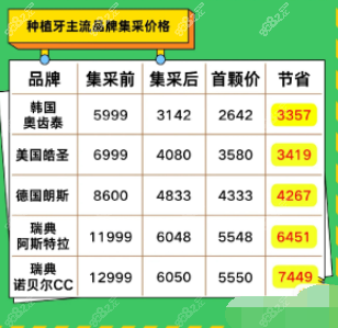 西安种植牙集采价格