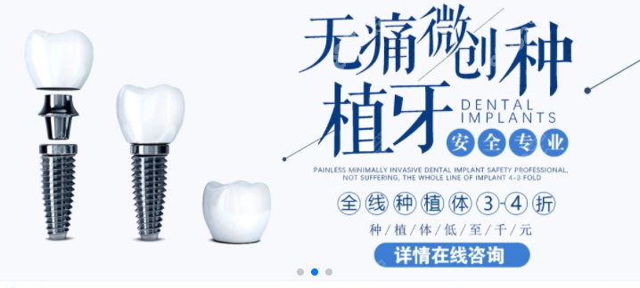 种植牙价格