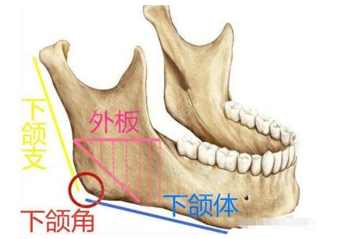 下颌骨劈外板示意图看劈外板主要是改善正面