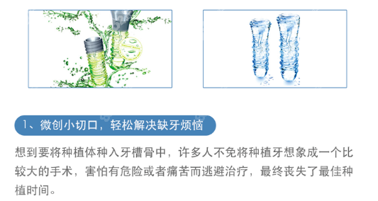 平顶山博华口腔种植牙价格www.8682.cc