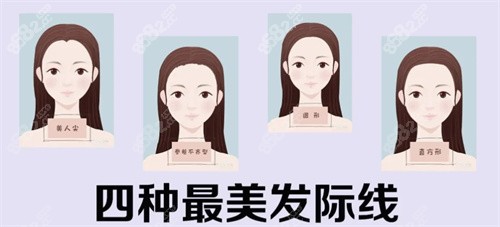 好看的发际线（标准型）