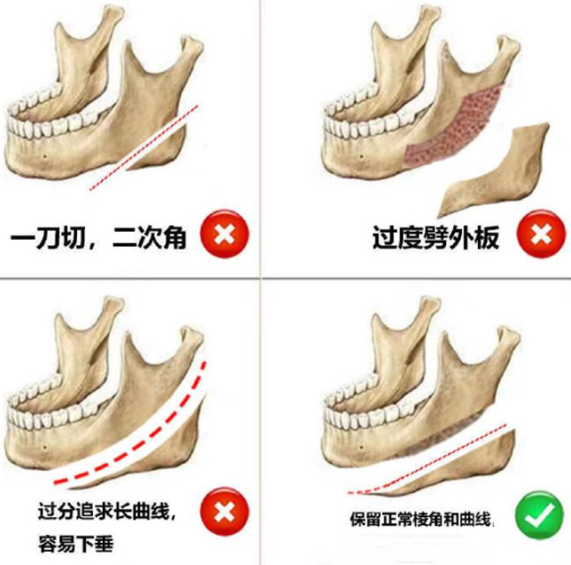 沈绍勇磨骨好在哪儿8682.cc