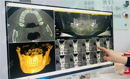 南通美奥口腔治疗设计图