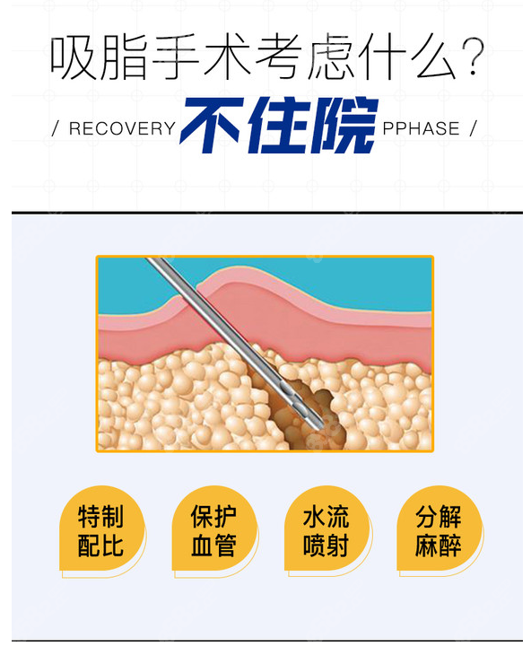 潘红伟医生面部吸脂实例www.8682.cc