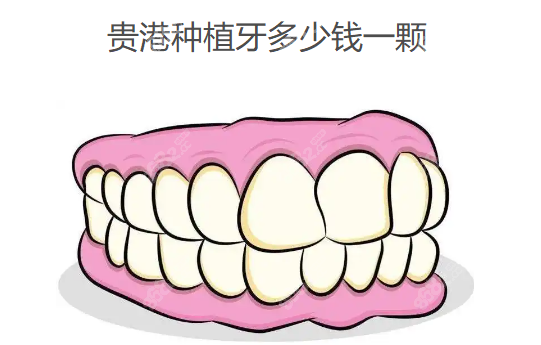 贵港种植牙多少钱一颗www.8682.cc