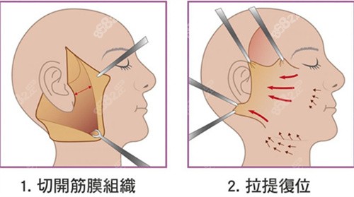 北京高亚东医生怎么面诊预约?