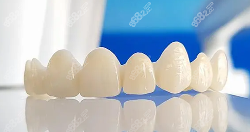 牙龈瓷效果图图片