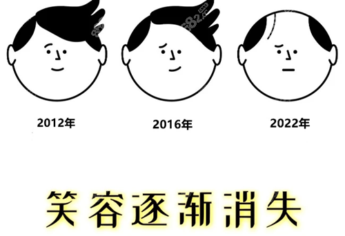 不剃发植发