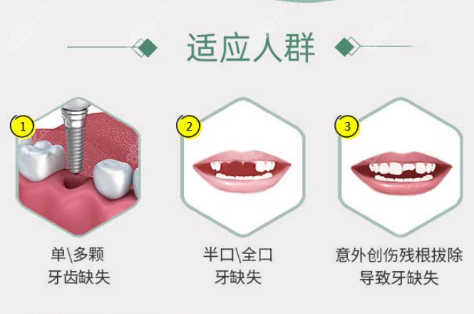 内江种植牙医院排行榜www.8682.cc