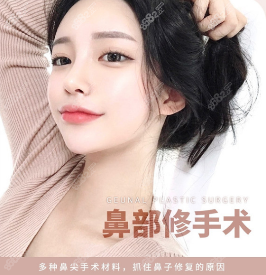 韩国歌娜整形鼻部修复手术