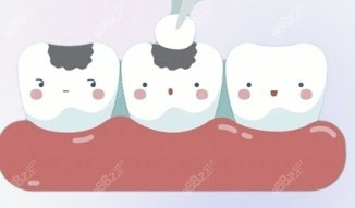 牙齿龋坏补后<span style=