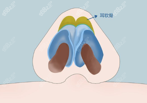 刘杰伟鼻修复技术如何