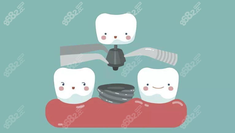 福州种植牙医院哪家好