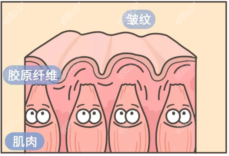 颈部拉皮手术后会有哪些后遗症？