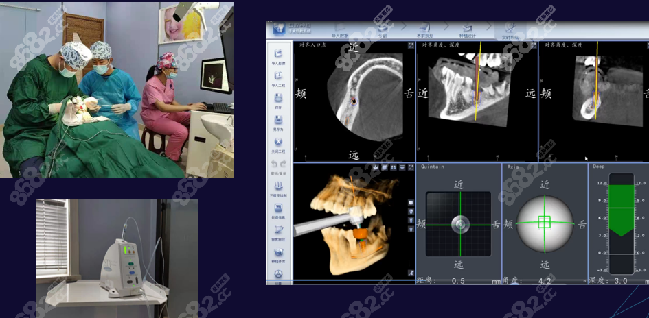 <!--<i data=20240705-sp></i>-->口腔医院种植牙怎么样？技术好价格低
