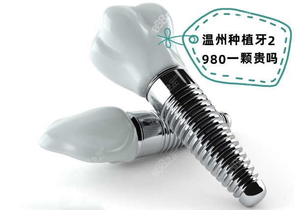 温州种植牙2980一颗贵吗