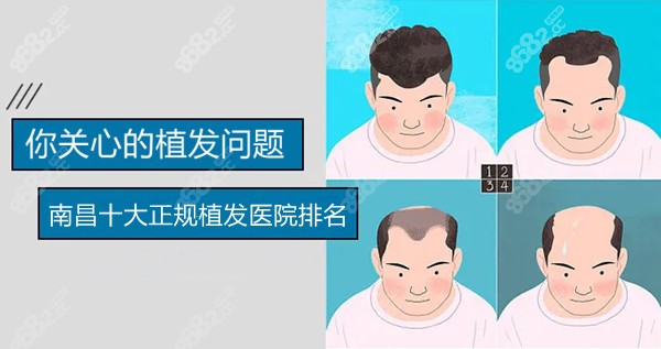 南昌十大正规植发医院排名公布