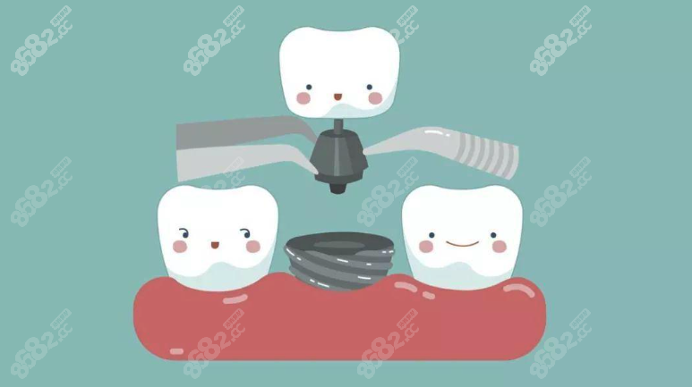 厦门牙齿种植医院哪家好