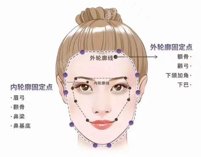 外轮廓固定+内轮廓填充适合大什么玻尿酸？