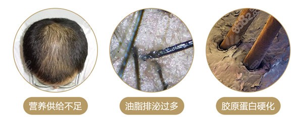 乌鲁木齐看脱发去哪家医院