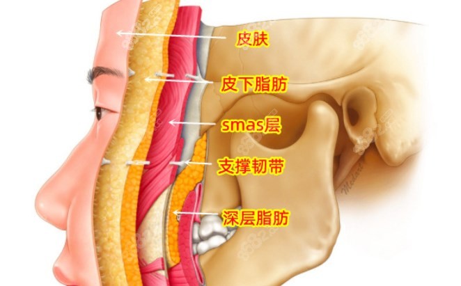 王驰拉皮能保持多久