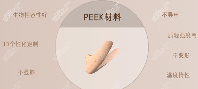peek人工骨材料修复下颌角凹陷怎么样 8682.cc