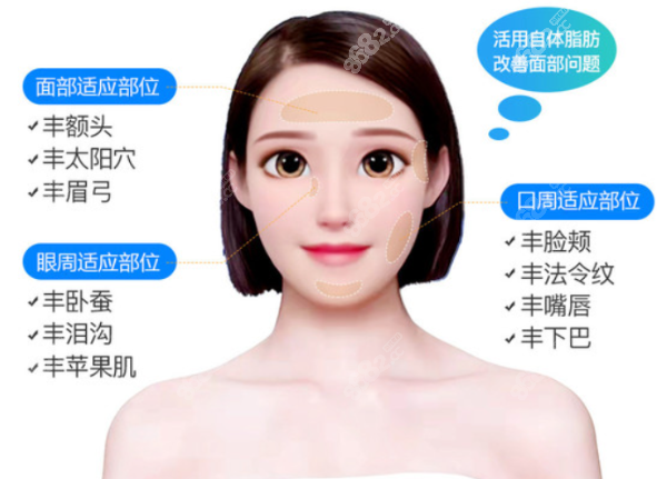 下颌角脂肪填充修复优缺点