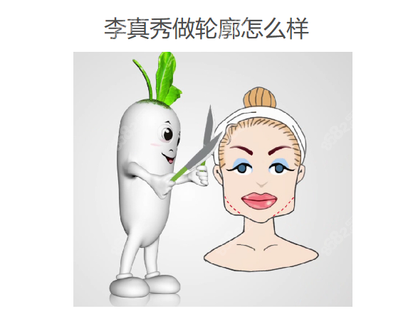 李真秀做轮廓怎么样www.8682.cc
